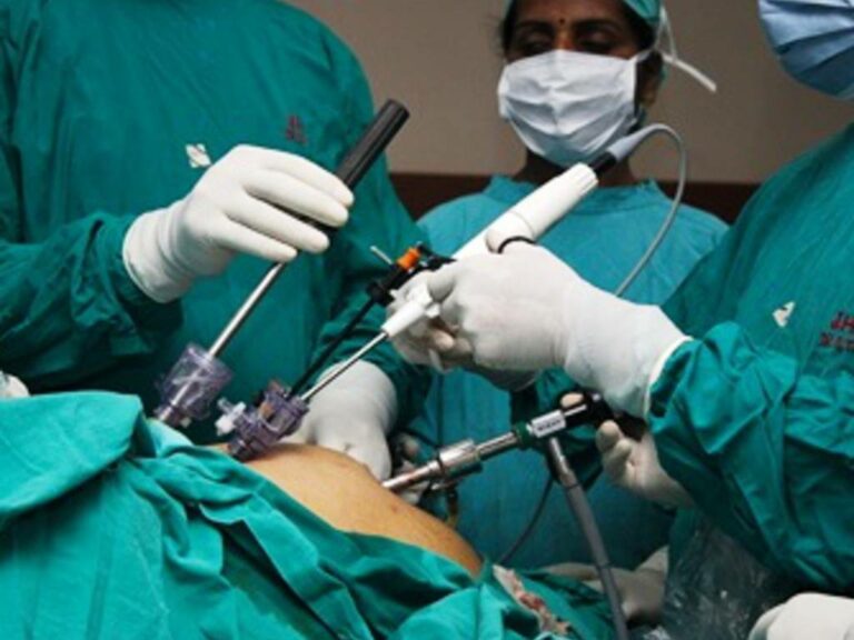 Ospedale Monaldi, asportato tumore 4Kg con laparoscopia