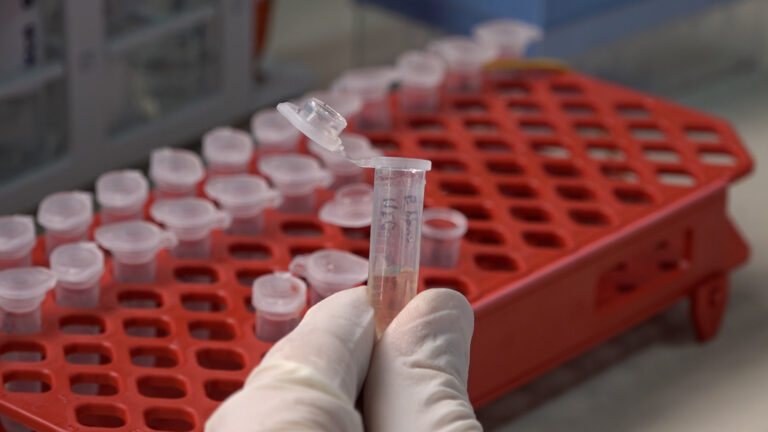 Campania 4° in Italia per casi Hiv, il piano della Regione