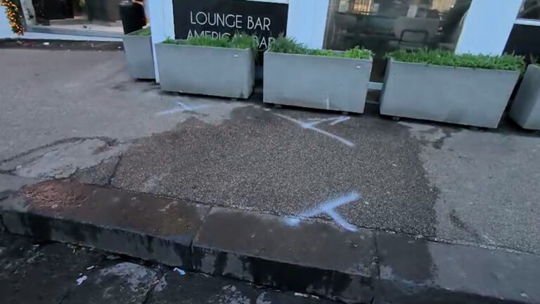 Incidente stradale a Fuorigrotta: muore dopo 10 giorni pedone travolto