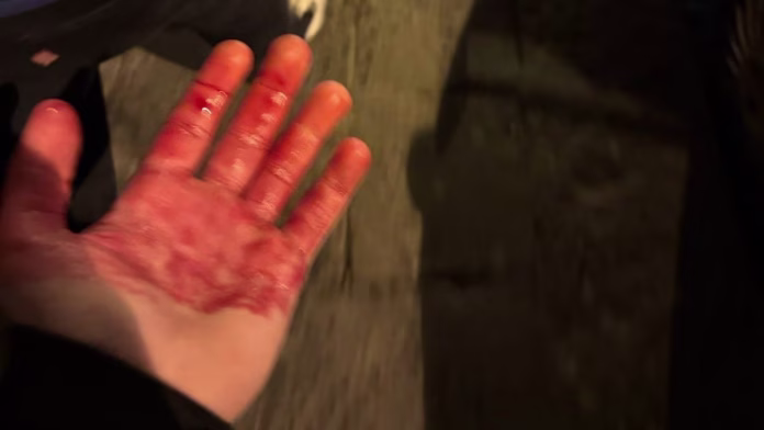 Tifoso del Chelsea accoltellato