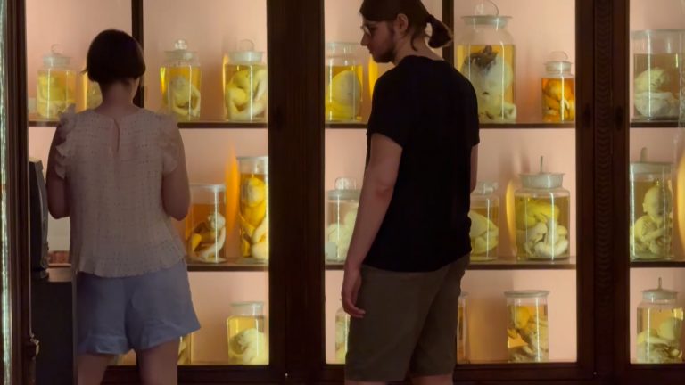 “Admiranda e Arcana naturae”, inaugurata mostra museo anatomico