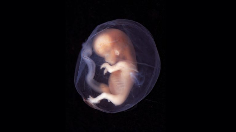Dopo la fecondazione in vitro scoprono che la bimba non è la loro: indagini a tutto campo all'ospedale San Paolo di Napoli